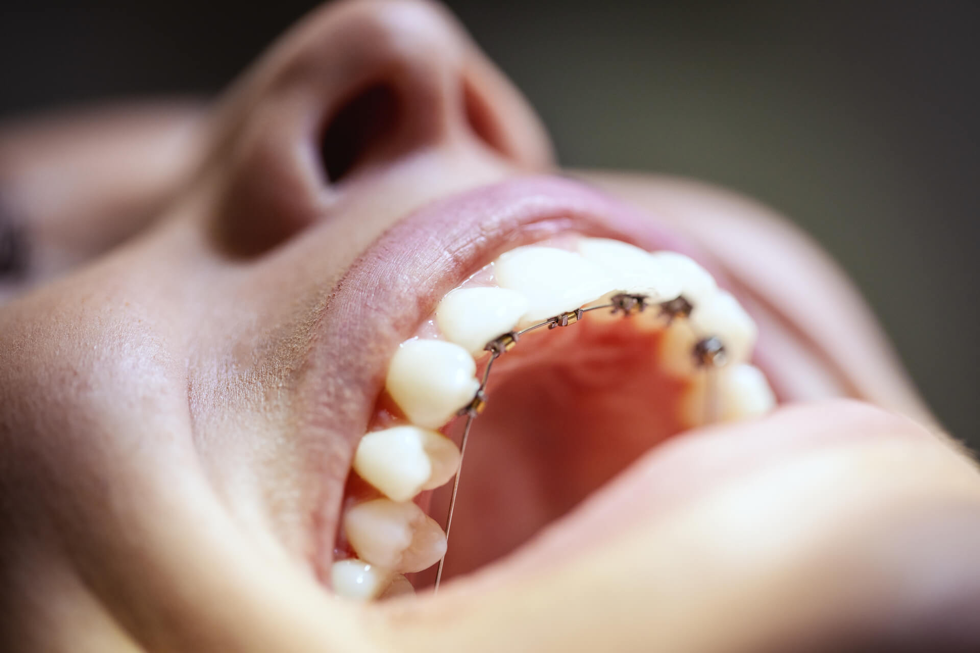 medium-vecteezy_for-healthy-teeth_13879197_medium (1)